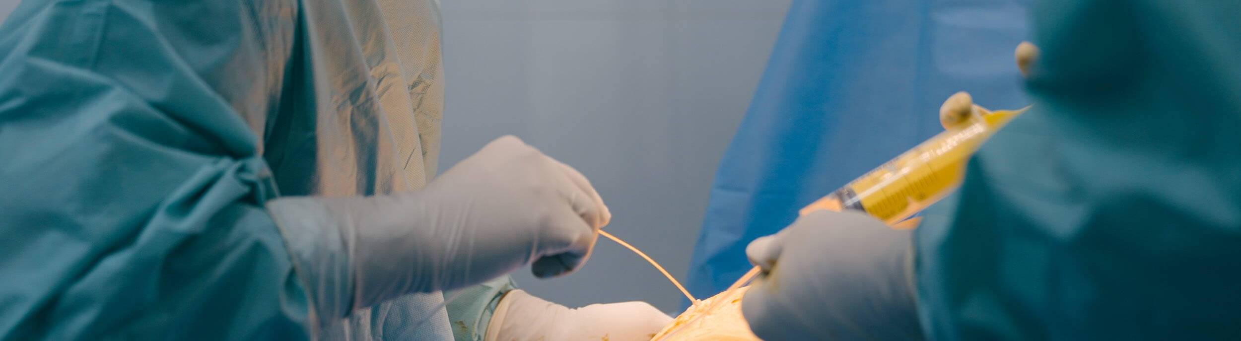 How much is liposuction in the UK?