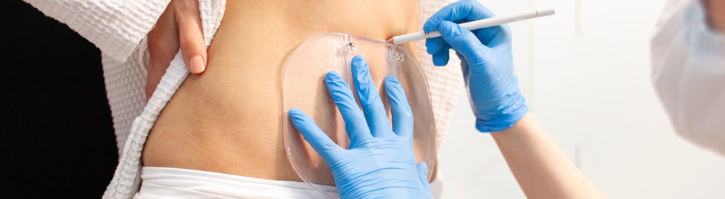 What is vaser liposuction?