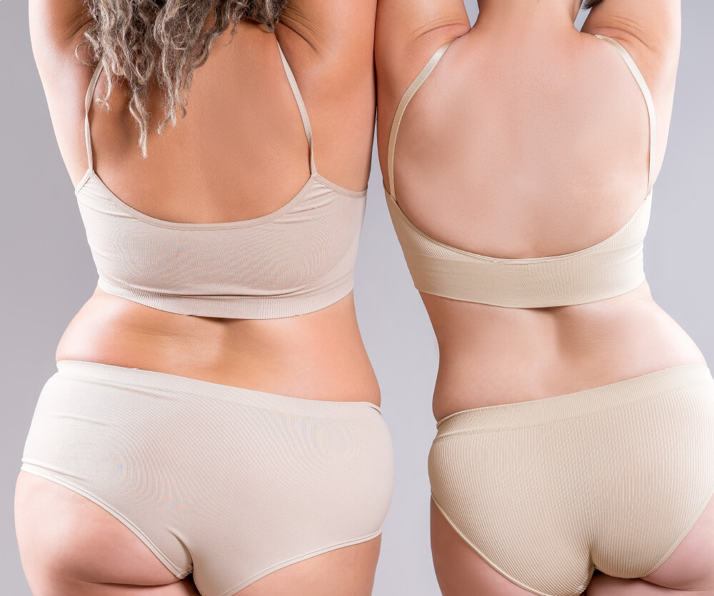 What is a 360 liposuction?