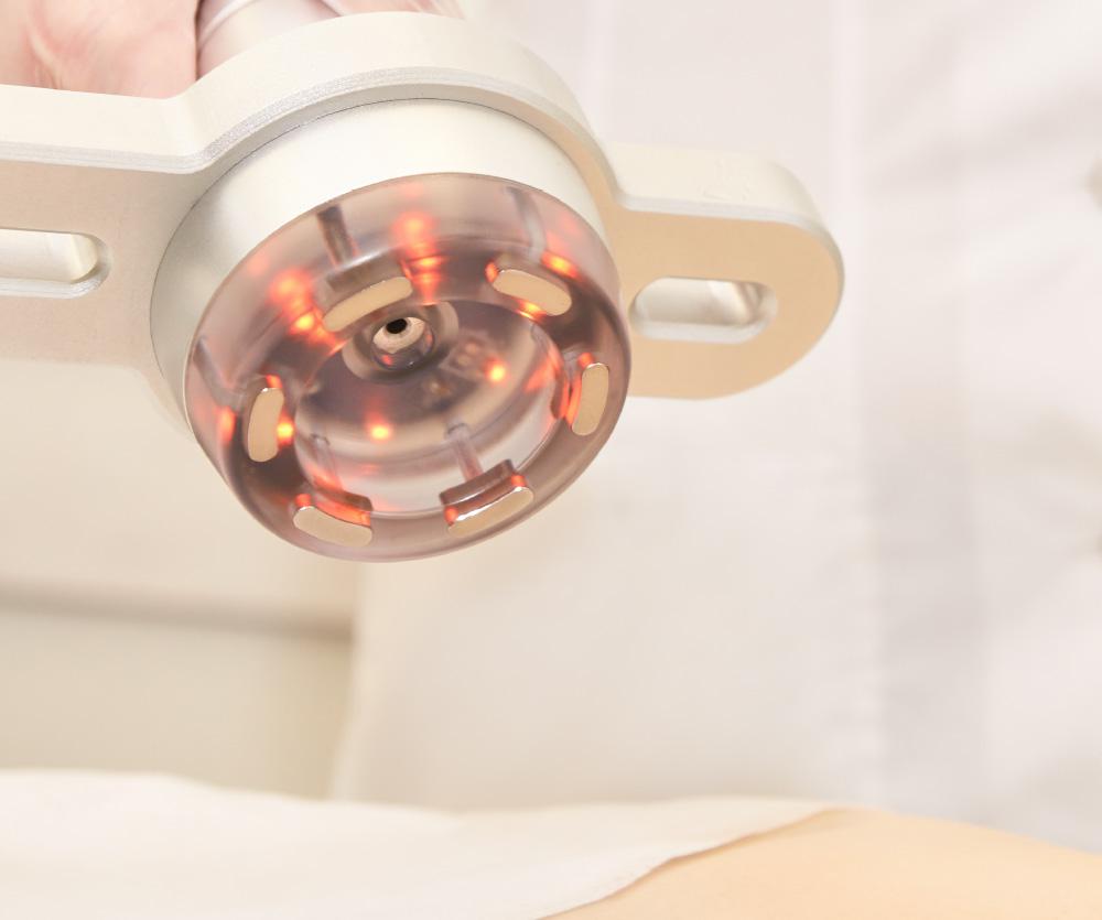 What is Lipo-Light body sculpting?