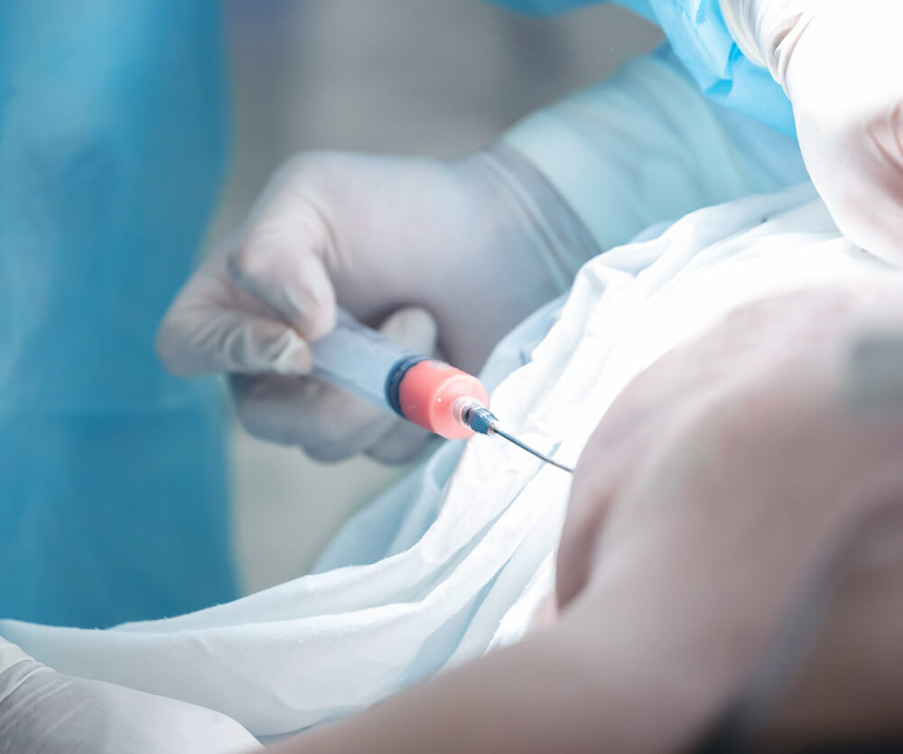 How much fat can liposuction remove?