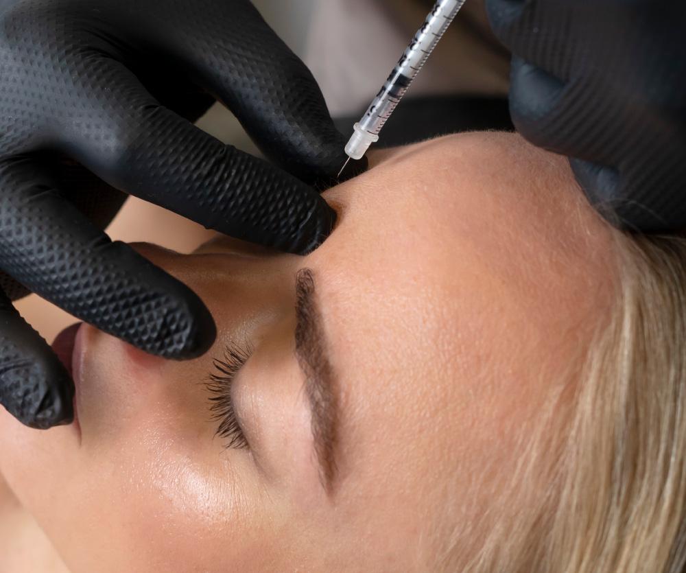 När ska man börja med botox?