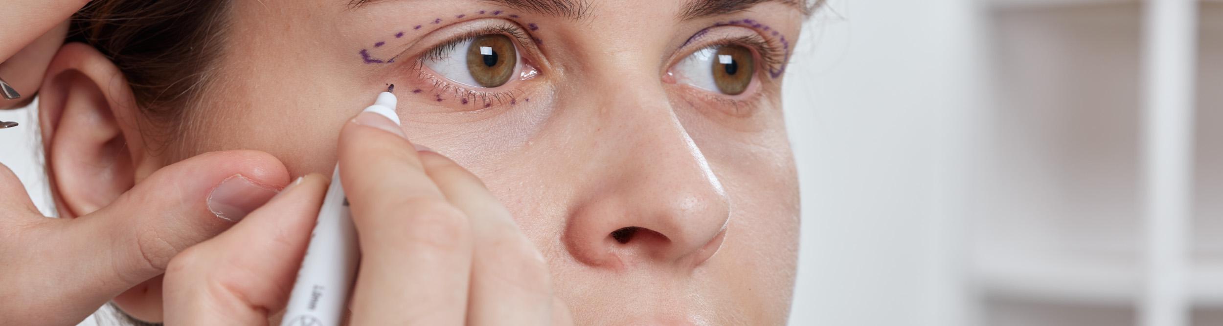 How much is blepharoplasty? – UK prices
