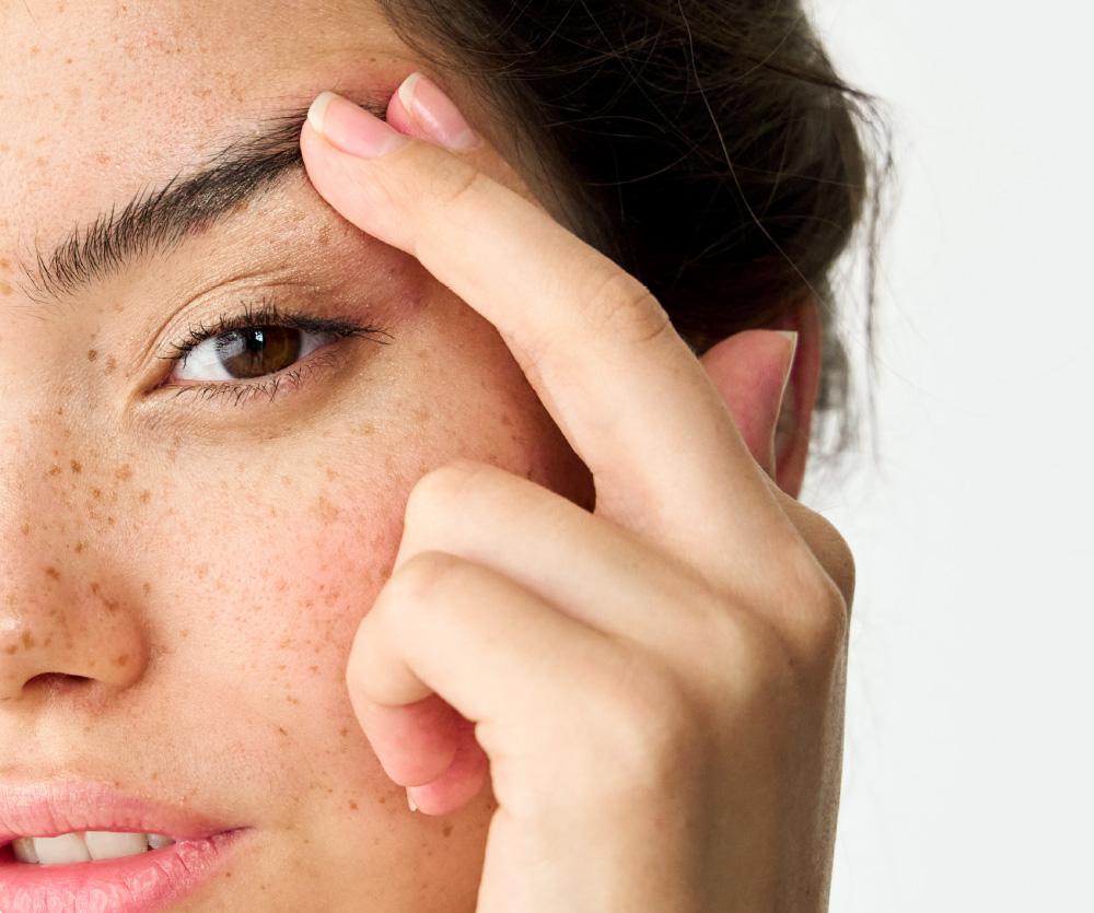 How long does it take to recover from blepharoplasty?