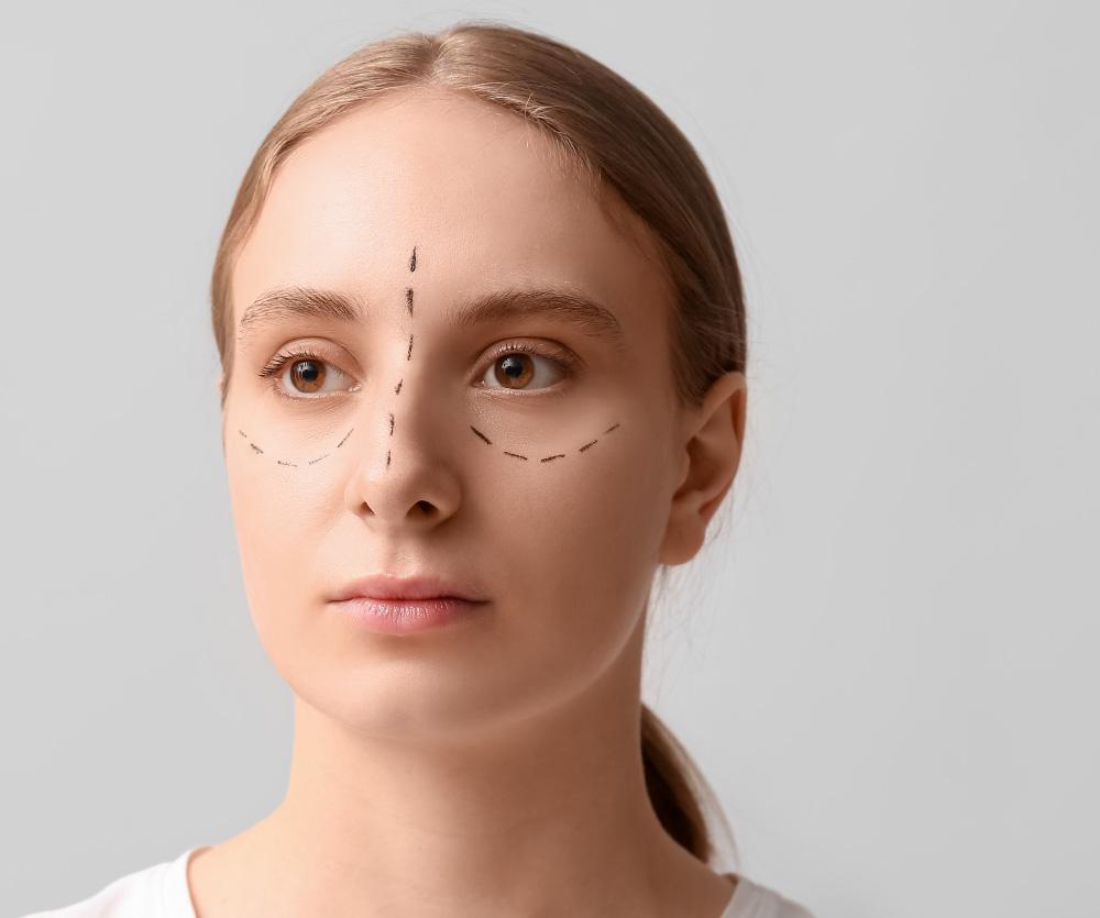 How to massage eyelids after blepharoplasty