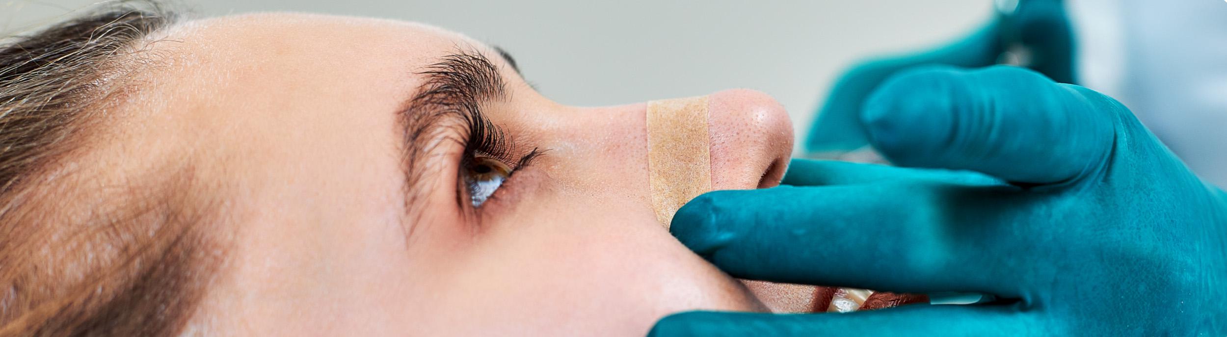 Septoplasty recovery