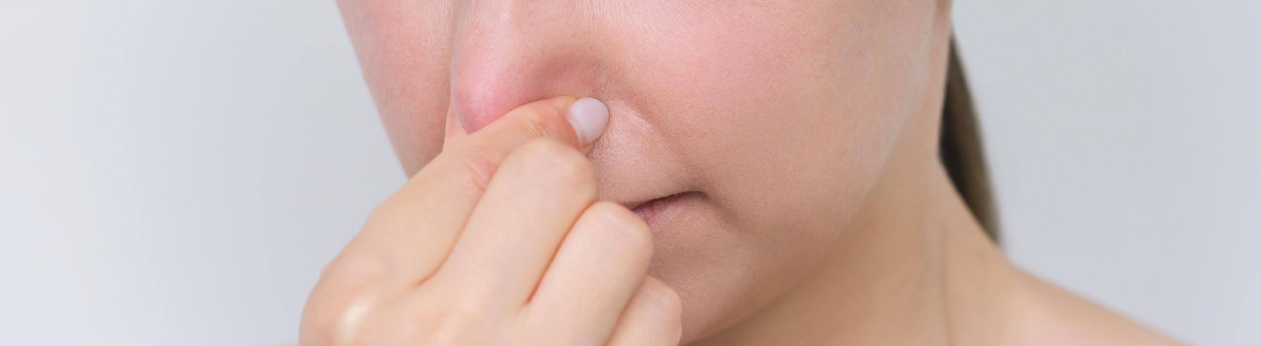 Nose blocked after septoplasty