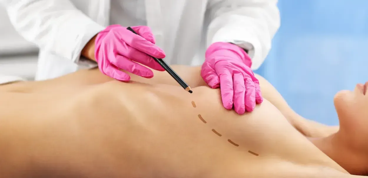 Bröstlyft med implantat