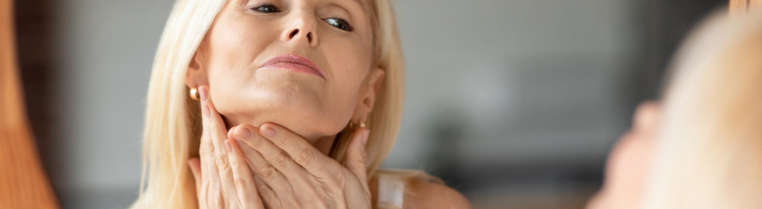 Neck lift before and after