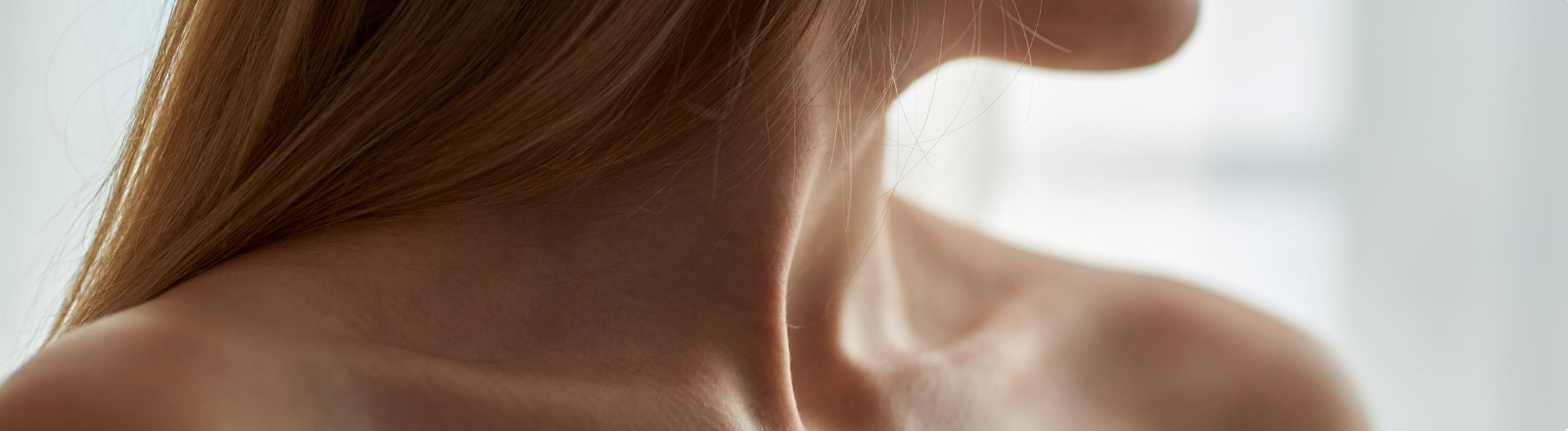 Neck lift scars