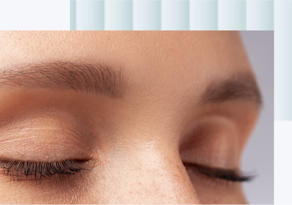 VAD ÄR BOTOX?