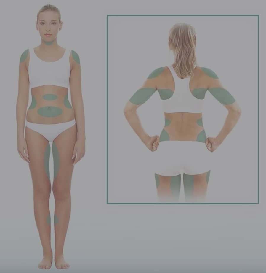 Body Contouring Recovery: A Realistic Week-by-Week Guide