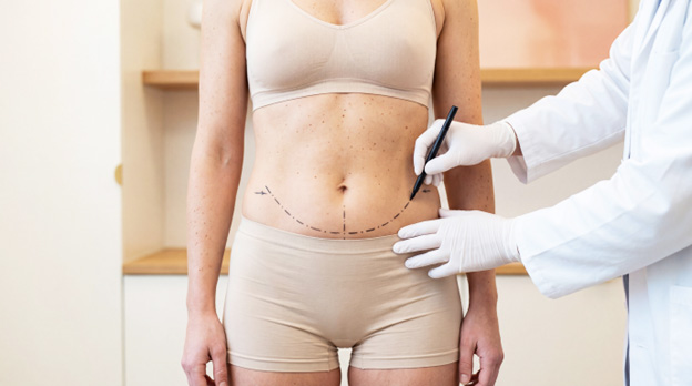 A person wearing beige undergarments, standing with their arms at their sides, while a gloved hand holds a pen marking a curved dotted line on their abdomen.