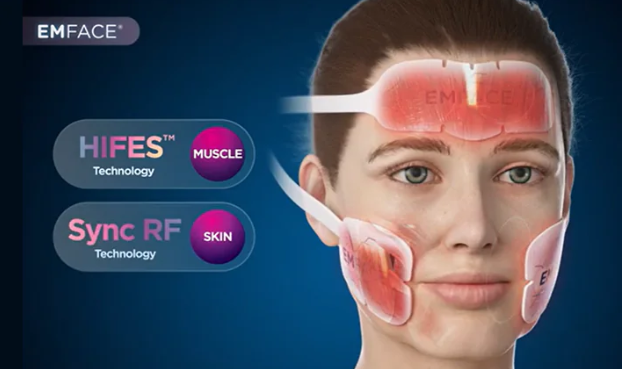illustration of emface treatment