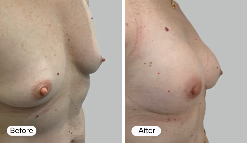 A side-by-side comparison image labeled 'Before' and 'After', showcasing variations in appearance.