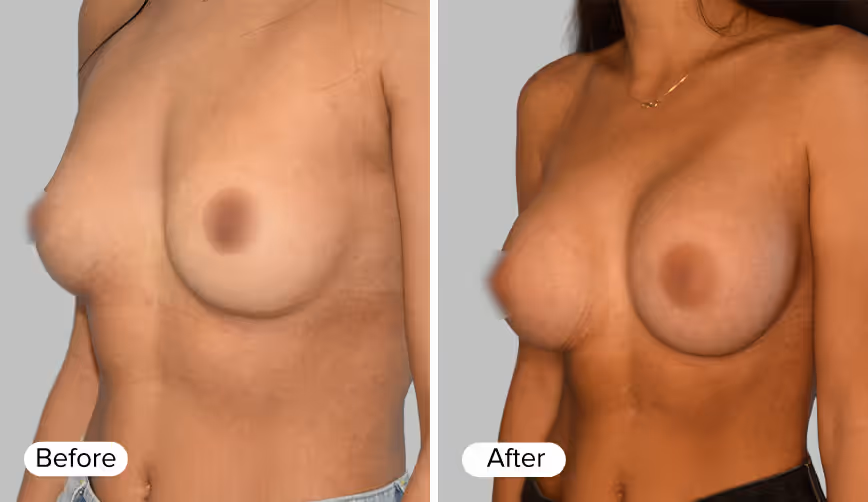 A side-by-side comparison image featuring two female figures. The left figure is labeled 'Before' and the right figure is labeled 'After', showcasing a change in appearance.