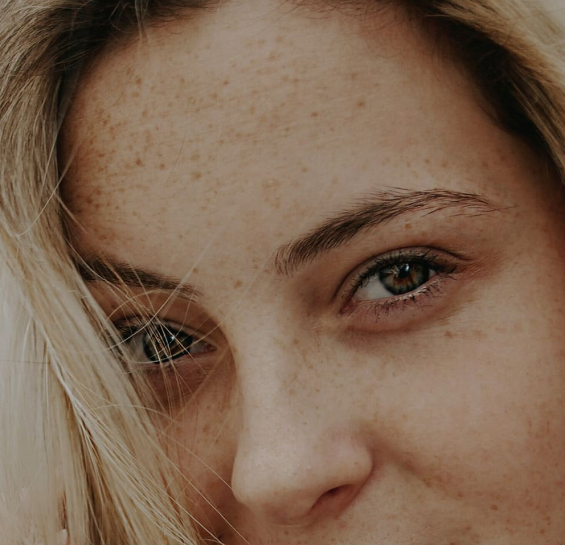 Blepharoplasty at N1