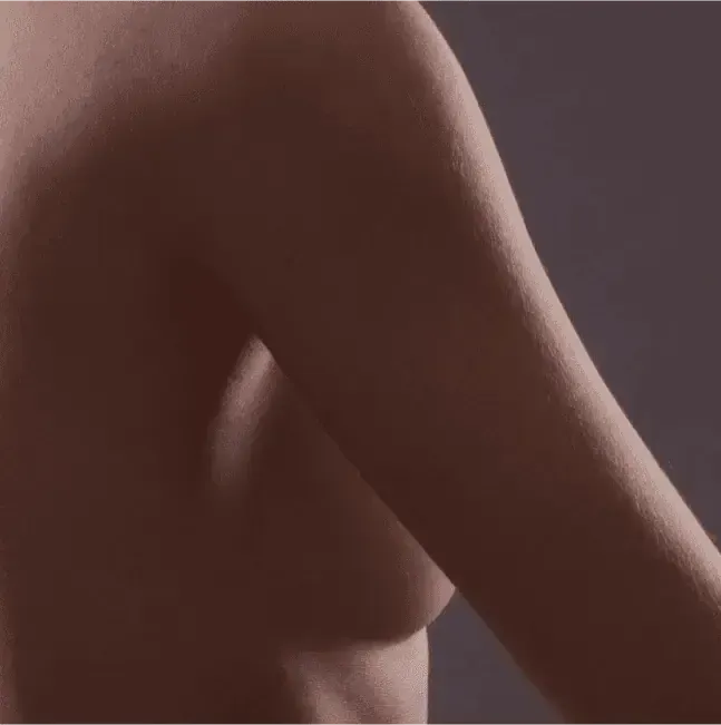 Breast lift techniques