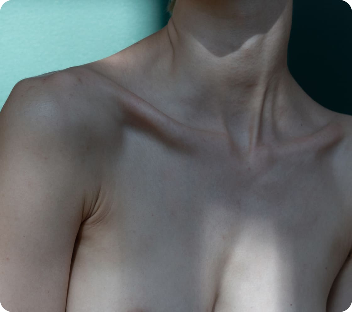 Understanding Nipple & Areola Correction