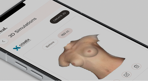 Crisalix 3D imaging preview on screen
