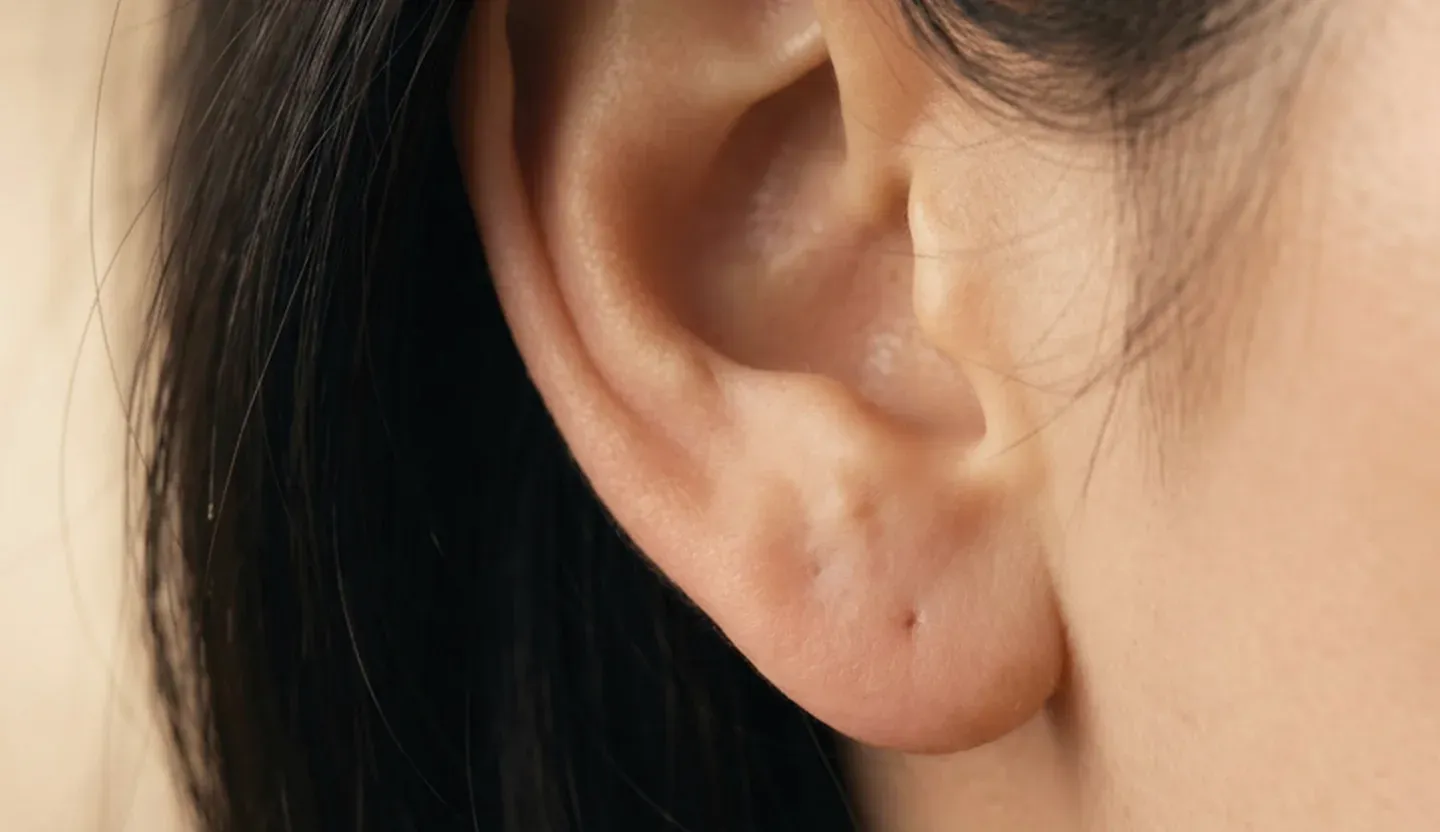 Profile portrait of a woman in soft natural light – facial surgery at Skulpturkliniken