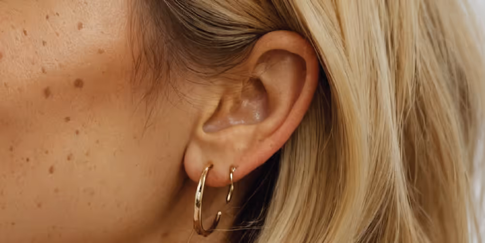 How Can I Treat My Prominent Ears?