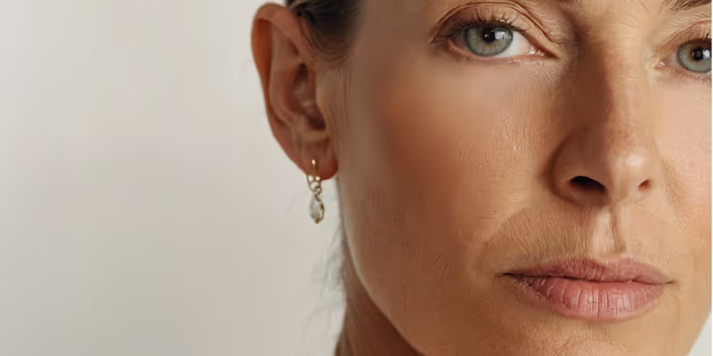 Introducing Micro-Needling And PRP At South Coast Plastic Surgery
