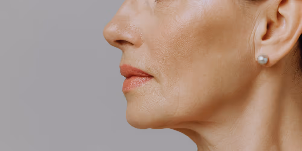 Restore Lost Volume With Facial Fat Grafting